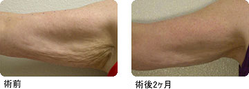 �r���̂���݈�������