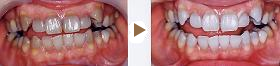 ���[�U�[�z���C�g�j���O�Ǘ�ʐ^